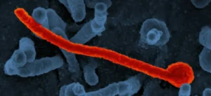 national-institute-of-allergy-and-infectious-diseases-UASwQWDeQoc-ebola ...
